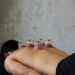 Cup,Massage,Close,Up.,Сans,For,Massage,On,The,Man's